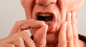 Perda de dentes