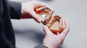 Dentista segurando uma Prótese dentária