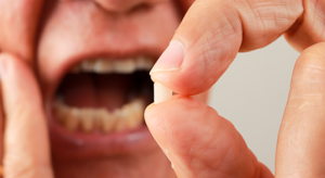 Perda de dentes